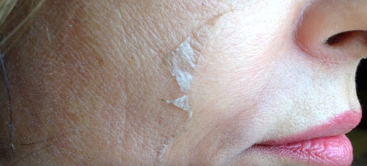 The Perfect Derma Peel Clinical Facial | St. Louis Park Woodbury MN | Aesthetica Skin Health